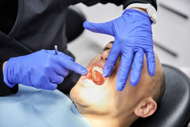 Best Emergency Dentist for Special Needs Patients in Glouster, OH