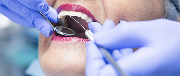 Best Emergency Dental Care for Abscessed Tooth in Glouster, OH
